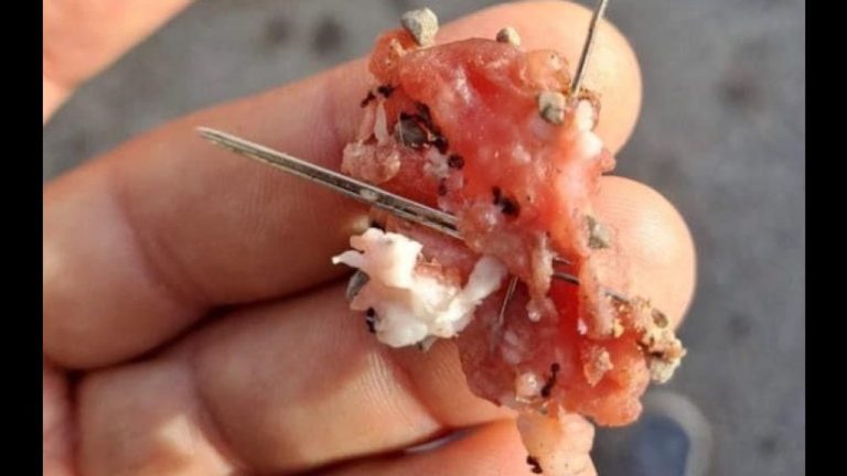 Perro recibió 10 agujas en el estómago… después de comer albóndigas en la calle